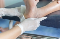 Causes and Definition of Foot Ulcers