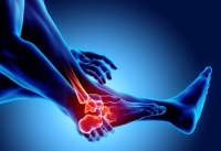 The Feet Can Develop Forms of Arthritis