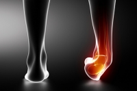 Understanding High Ankle Sprains