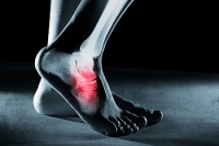 What Is a Navicular Stress Fracture?