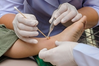 Why Foot Wounds Heal Slowly in Diabetics